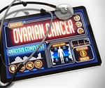 Australian research finds wine reduces ovarian cancer risk