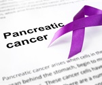 New AI blood test tracks pancreatic cancer treatment response