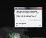 iBox Scientia Imaging System to Monitor Progression of Tumor Lesions