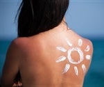 Multimodal AI technology boosts early detection of skin conditions