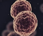 BOLD MRI as a New Method for Monitoring Hypoxia in Tumors