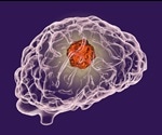 Novel MRI methodology facilitates evaluation of sporadic cancer in mouse models