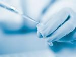 p-Tau 217 for Alzheimer's disease research