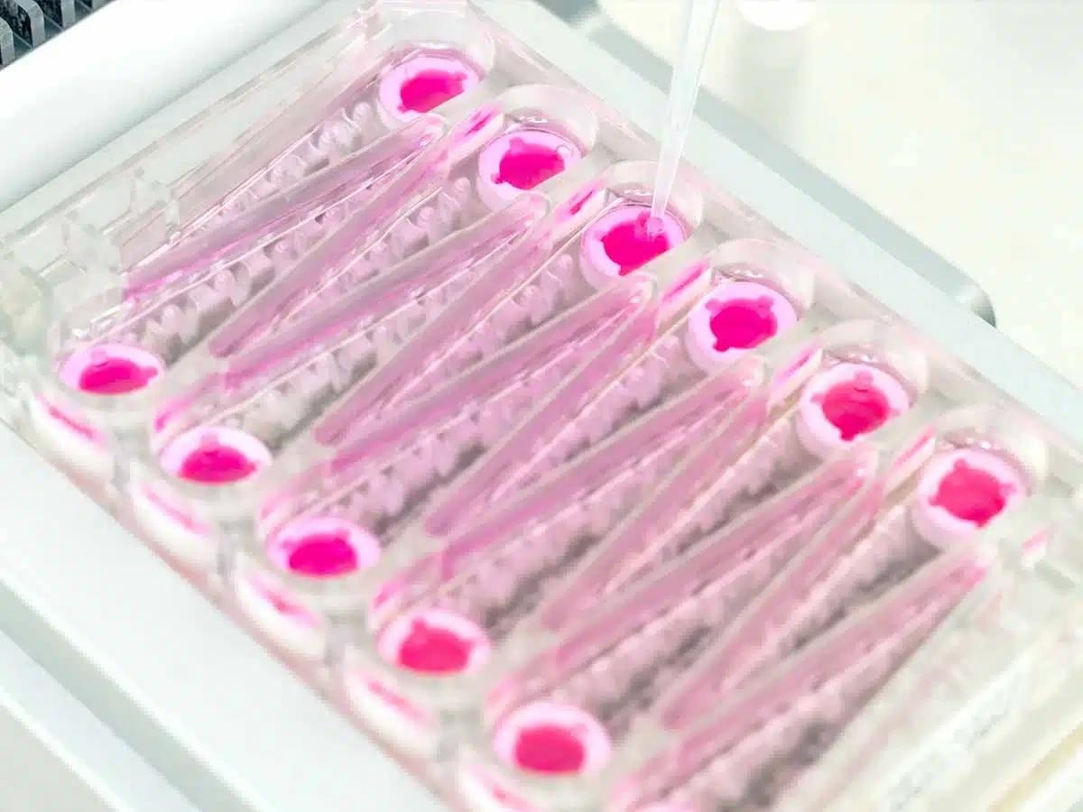 Drug-induced liver injury (DILI) in vitro services to predict human hepatotoxicity